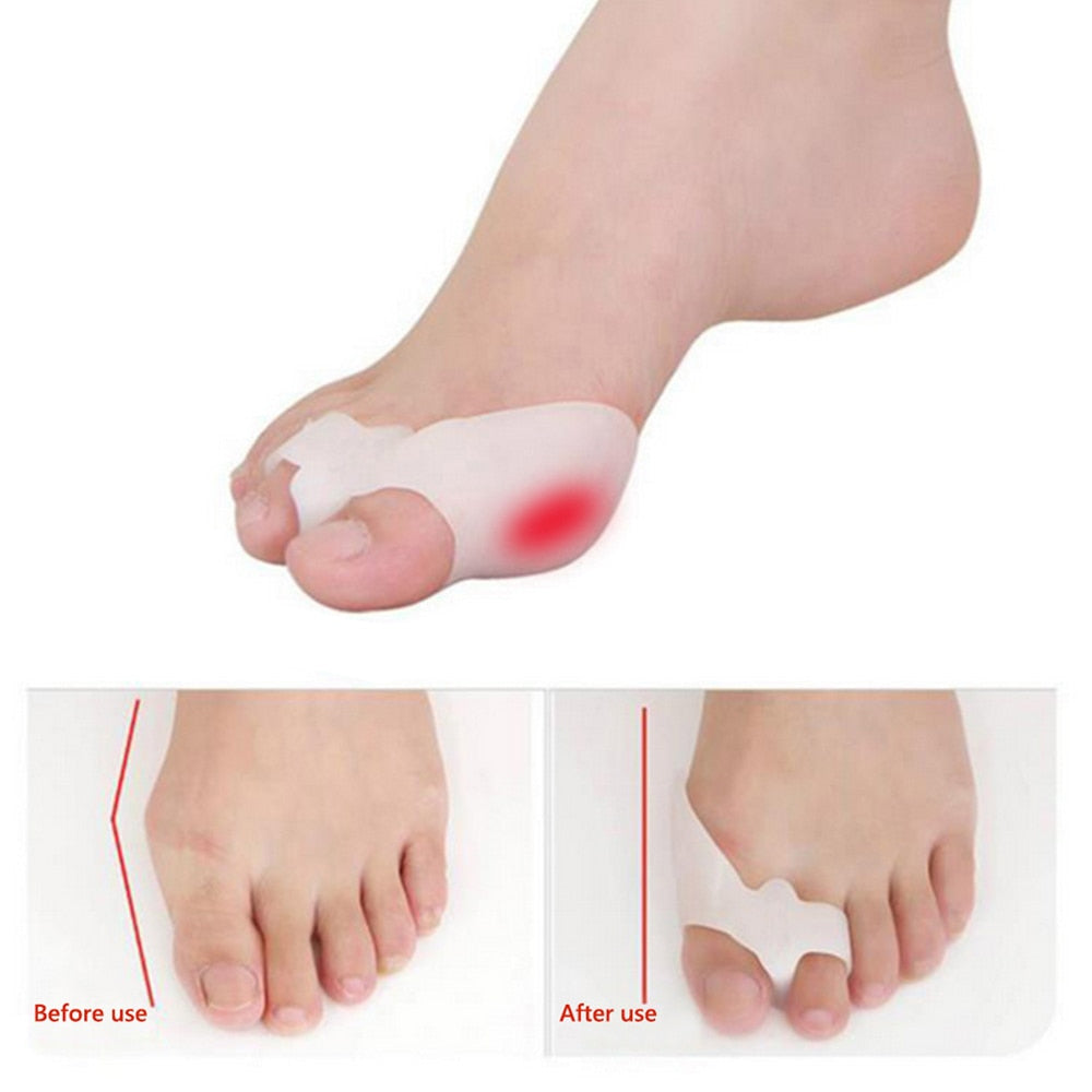 2Pcs Silicone Gel Foot Toes Two Hole Toe Separator Thumb Valgus Protector Bunion Hallux Valgus Guard Feet Overlapping Pad Insert